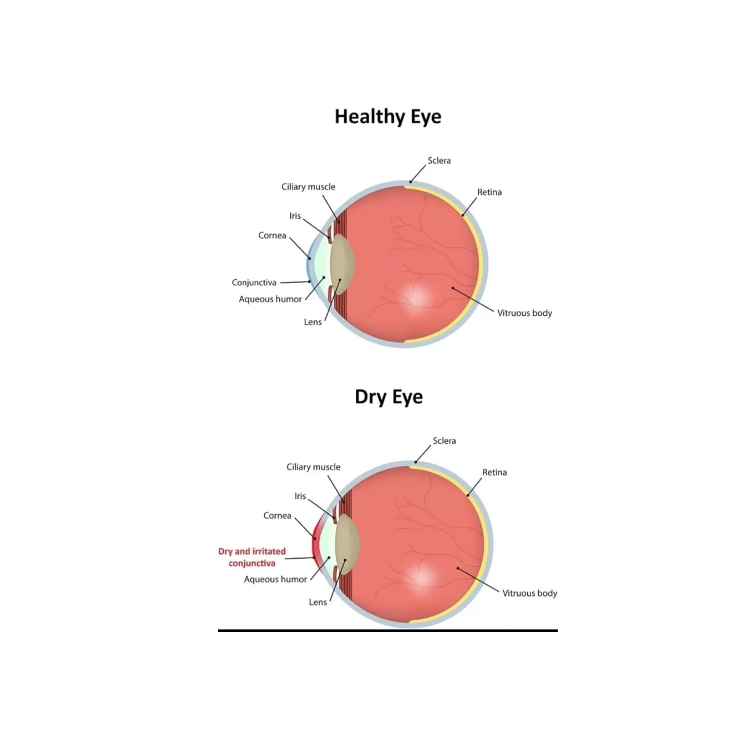 Vizulize Multi Action Eye Wash