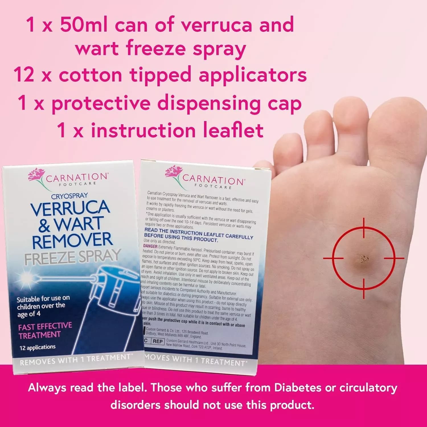 Carnation Verruca and Wart Remover Freeze Spray 50ml