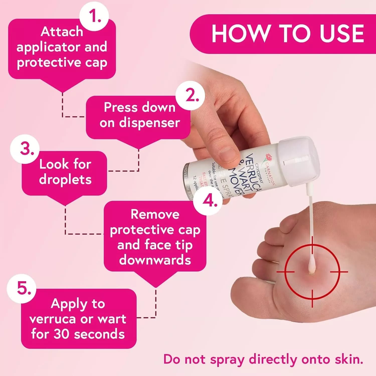 Carnation Verruca and Wart Remover Freeze Spray 50ml