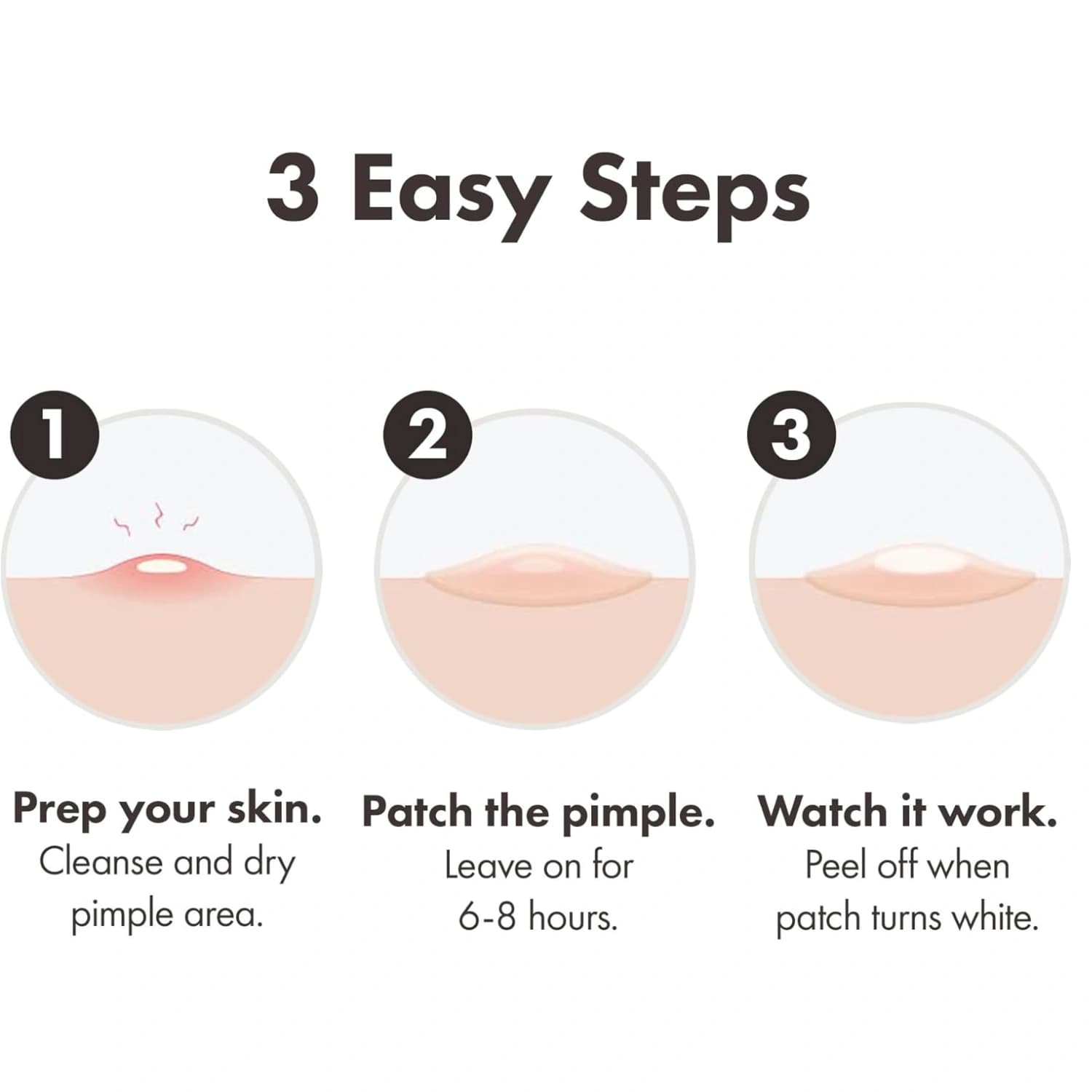 Hero Mighty Pimple Patch Original Pack of 24