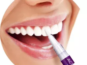 Wisdom-Teeth-Active-Whitening-Pen (2)